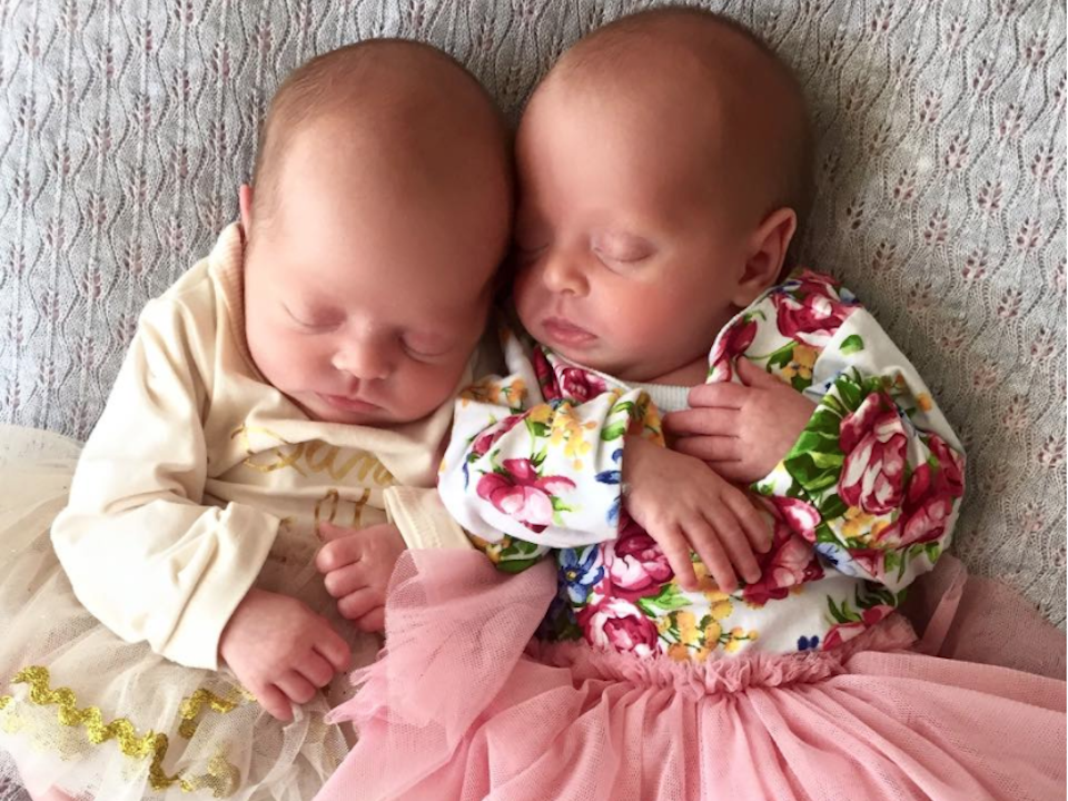 Newborn identical twin girls in adorable tutus with their heads touching|Louis Vuitton and designer hospital bags|Sophie Guidolin postpartum in recovery shorts and posing