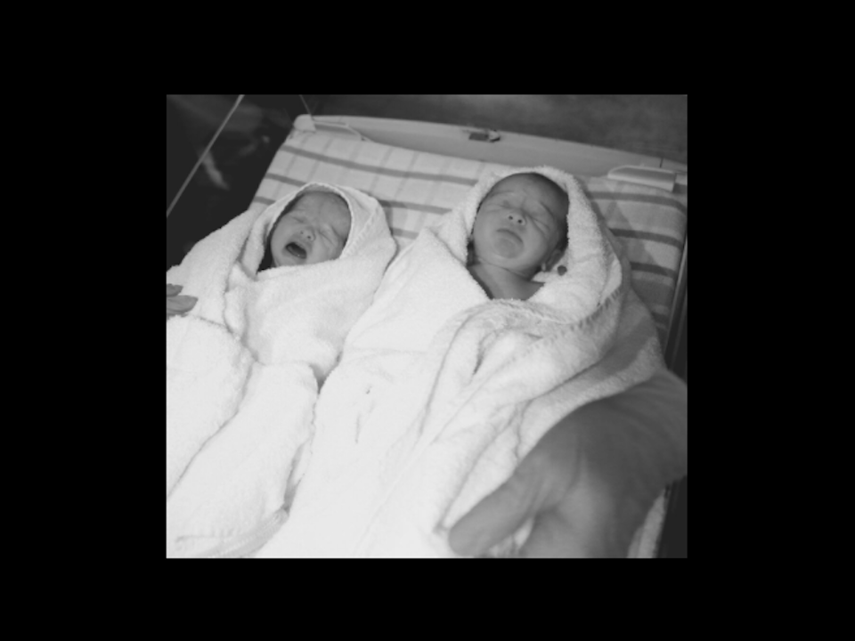 Sophie Guidolin's newborn identical twin girls right after being born in black and white
